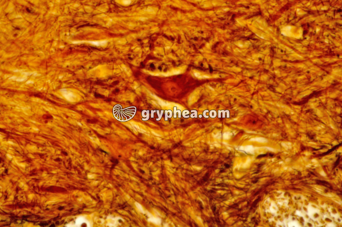 Moelle épinière x160 - gryphea.com